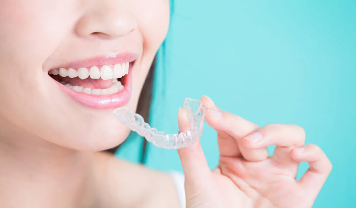 Invisalign & Clear Aligners at Keluarga Dental Smile, Sentul Kuala Lumpur